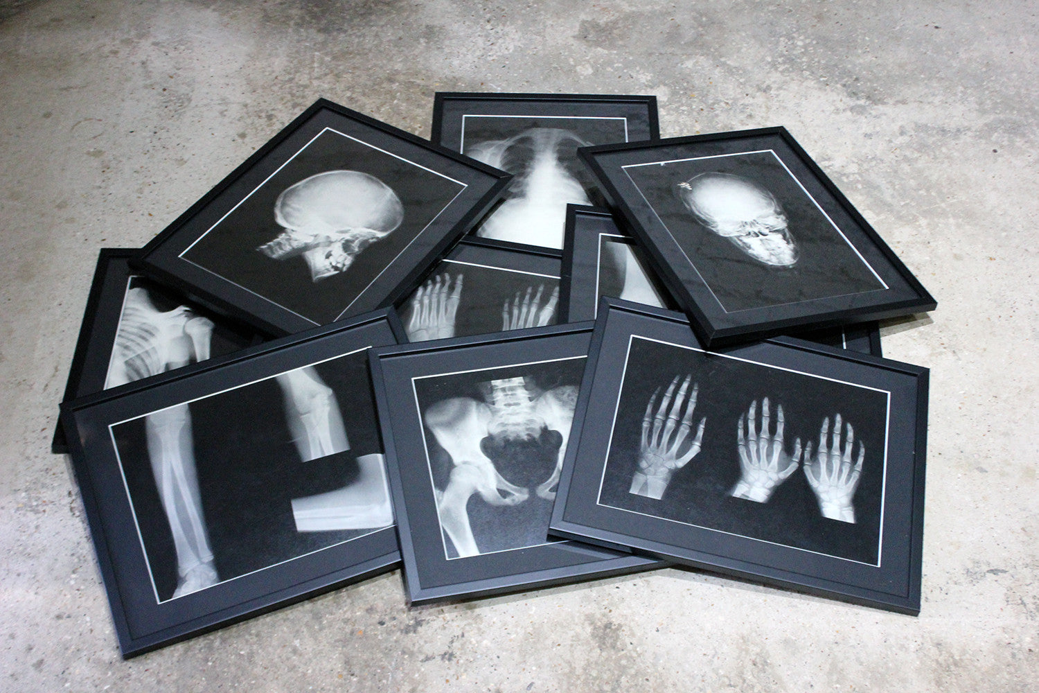 A Striking Group of Nine Framed Mid-Century Medical X-Ray Imaging