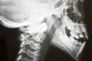 A Striking Group of Nine Framed Mid-Century Medical X-Ray Imaging Teaching Aids c.1950-60