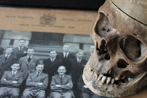 An Early 20thC Human Skull for Odontology & Medical Study from Guy's Hospital Dental School