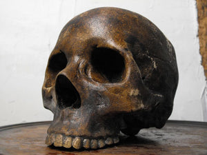 A Macabre 19thC Plaster Human Skull for Medical Use