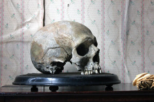 A Well Patinated 19thC Male Human Skull on Stand