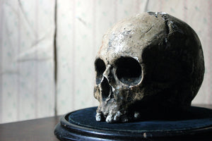 An Early 20thC Plaster Model of a Human Skull on Ebonised Stand