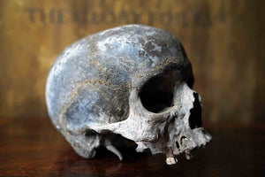 An Early & Well Patinated Relic Human Skull; Pre c.1800