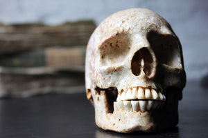 A Very Rare Mid-19thC Carved Whale Bone Skull Set with Human Teeth